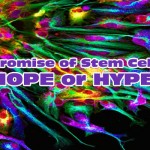 The Promise of Stem Cells: Hope or Hype?