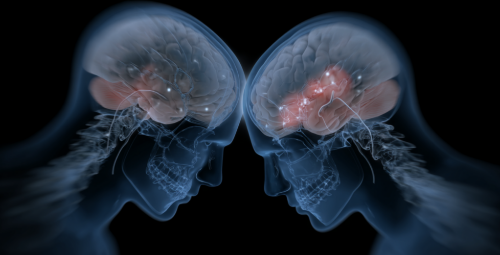 NeuralSynchrony